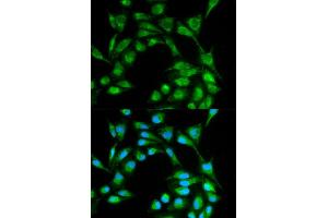 Immunofluorescence analysis of MCF7 cell using ICOS antibody. (ICOS 抗体)