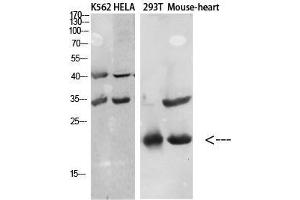 Western Blot (WB) analysis of specific cells using Antibody diluted at 1:1000. (CCL27 抗体)