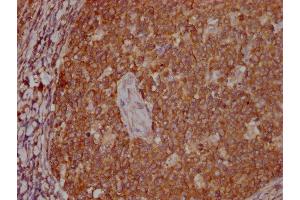 Immunohistochemistry (IHC) image for anti-Pyruvate Kinase M1/2 (PKM) (AA 2-531) antibody (ABIN7166916)