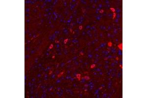 Immunofluorescentanalysis of paraffin embedded mouse cerebellum using Nrg4 (ABIN7074805) at dilution of 1: 300 (Neuregulin 4 抗体)