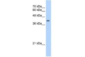 UROD antibody used at 2. (UROD 抗体  (N-Term))