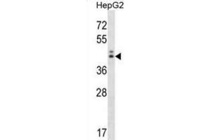 Western Blotting (WB) image for anti-Neuroguidin, EIF4E Binding Protein (NGDN) antibody (ABIN2998327) (NGDN 抗体)