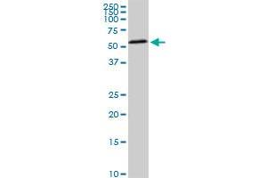 HDAC1 monoclonal antibody (M02), clone 3E1. (HDAC1 抗体  (AA 1-482))