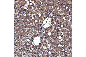 IHC analysis of SDF2L1 using anti-SDF2L1 antibody (ABIN7601111).