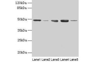 Western blot All lanes: FNTB antibody at 6 μg/mL Lane 1: Hela whole cell lysate Lane 2: CEM whole cell lysate Lane 3: HepG2 whole cell lysate Lane 4: SH-SY5Y whole cell lysate Lane 5: A549 whole cell lysate Secondary Goat polyclonal to rabbit IgG at 1/10000 dilution Predicted band size: 49, 44 kDa Observed band size: 49 kDa (FNTB 抗体  (AA 1-300))