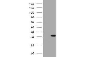 Image no. 1 for anti-BCL2/adenovirus E1B 19kDa Interacting Protein 1 (BNIP1) (AA 1-199) antibody (ABIN1490606) (BNIP1 抗体  (AA 1-199))