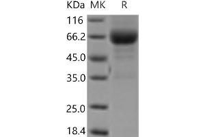 Western Blotting (WB) image for Interleukin 4 Receptor (IL4R) (Active) protein (Fc Tag) (ABIN7196566) (IL4 Receptor Protein (Fc Tag))