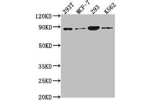 Western Blot Positive WB detected in: 293T whole cell lysate, MCF-7 whole cell lysate, 293 whole cell lysate, K562 whole cell lysate All lanes: P0C869 antibody at 1:2000 Secondary Goat polyclonal to rabbit IgG at 1/50000 dilution Predicted band size: 88, 101, 55, 115 kDa Observed band size: 88 kDa (PLA2G4B 抗体  (AA 514-781))