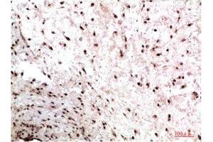 Immunohistochemical analysis of paraffin-embedded Human Colon Carcinoma Tissue using HP-1γ Mouse mAb diluted at 1:200. (CBX3 抗体)