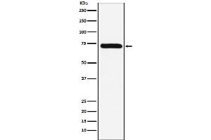 Western blot analysis of Factor X expression in HepG2 cell lysate.