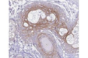 ABIN6273894 at 1/100 staining human prostate cancer tissues sections by IHC-P.