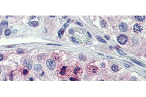 Immunohistochemistry (IHC) image for anti-Signal Transducer and Activator of Transcription 5B (STAT5B) (N-Term) antibody (ABIN2780884)
