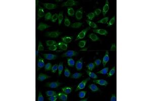 Immunofluorescence analysis of L929 cells using  Polyclonal Antibody  at dilution of 1:100 (40x lens). (ALDH3A2 抗体  (AA 250-320))