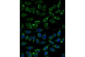 Immunofluorescence analysis of L929 cells using  Polyclonal Antibody  at dilution of 1:100 (40x lens). (ALDH3A2 抗体  (AA 250-320))