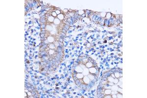 Immunohistochemistry of paraffin-embedded human appendix using MT-ND3 antibody (ABIN7268601) at dilution of 1:100 (40x lens).