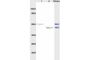 Lane 1: rat brain lysates Lane 2: rat heart lysates probed with Anti KCNN4 Polyclonal Antibody, Unconjugated (ABIN719786) at 1:200 in 4 °C. (KCNN4 抗体  (AA 325-427))