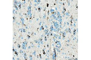 IHC analysis of SIAE using anti-SIAE antibody (ABIN7600774).