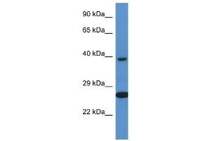 Western Blot showing XRCC3 antibody used at a concentration of 1 ug/ml against ACHN Cell Lysate (XRCC3 抗体  (C-Term))
