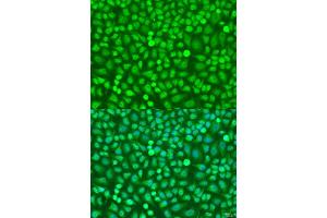 Immunofluorescence analysis of U2OS cells using HOXB5 antibody (ABIN7267769) at dilution of 1:100. (HOXB5 抗体  (AA 1-170))