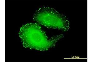Immunofluorescence of monoclonal antibody to TNS4 on HeLa cell. (Tensin 4 抗体  (AA 1-480))