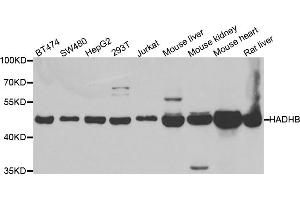 Western blot analysis of extracts of various cell lines, using HADHB antibody (ABIN5973344) at 1/1000 dilution. (HADHB 抗体)