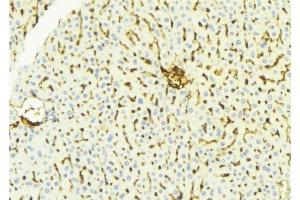 ABIN6275895 at 1/100 staining Mouse liver tissue by IHC-P. (MCPH1 抗体  (N-Term))