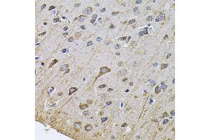 Immunohistochemistry of paraffin-embedded rat brain using DRD3 Antibody. (DRD3 抗体)