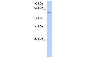 MTA3 antibody used at 0. (MTA3 抗体  (C-Term))