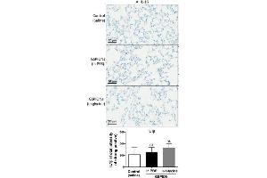 GSPIONs do not increase expression of pro-inflammatory cytokines in lung parenchyma. (IL-1 beta 抗体  (AA 101-200))