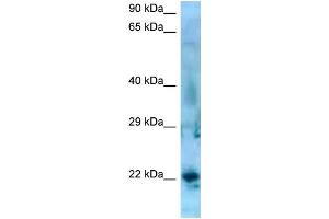 WB Suggested Anti-SSX5 Antibody   Titration: 1. (SSX5 抗体  (C-Term))