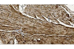 IHC analysis of Alpha B Crystallin/CRYAB using anti-Alpha B Crystallin/CRYAB antibody (ABIN7601209).