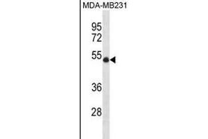 UBR7 Antibody (N-term) (ABIN1881973 and ABIN2838438) western blot analysis in MDA-M cell line lysates (35 μg/lane).