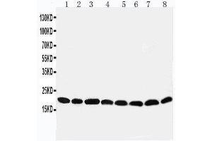Western Blotting (WB) image for anti-Peroxiredoxin 5 (PRDX5) (AA 166-181), (C-Term) antibody (ABIN3044202) (Peroxiredoxin 5 抗体  (C-Term))