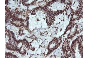 Image no. 10 for anti-Fetal and Adult Testis Expressed 1 (FATE1) antibody (ABIN1498222)