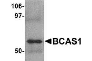 Western blot analysis of BCAS1 in human lung tissue lysate with BCAS1 antibody at 1 μg/ml. (BCAS1 抗体  (C-Term))