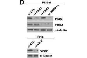 Prostate cancer cells-derived PKD2/3 promote chemotactic migration of mast cells and endothelial cells tube formation. (VEGFA 抗体  (AA 27-126))