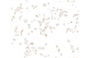 Immunocytochemistry (ICC) image for anti-Met Proto-Oncogene (MET) (C-Term) antibody (ABIN7795683) (Recombinant c-MET 抗体  (C-Term))