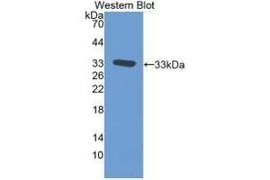Detection of Recombinant TFPI, Rat using Monoclonal Antibody to Tissue Factor Pathway Inhibitor (TFPI)