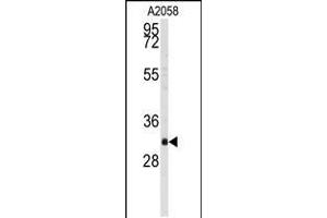 Western blot analysis of anti-BP2 Antibody in A2058 cell line lysates (35ug/lane) (WBP2 抗体  (C-Term))