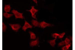 ABIN6275648 staining HeLa by IF/ICC. (PTPN22 抗体  (C-Term))
