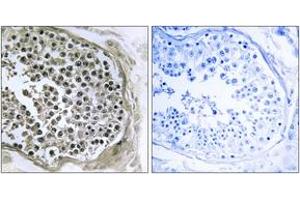 Immunohistochemistry analysis of paraffin-embedded human testis tissue, using GIDRP88 Antibody. (GIDRP88 抗体  (AA 721-770))