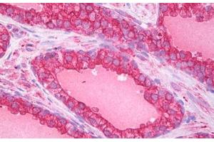Anti-ATG5 antibody IHC staining of human prostate. (ATG5 抗体  (AA 8-318))