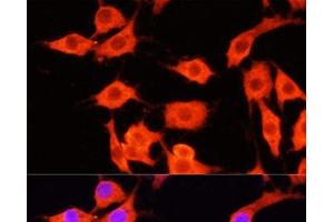 Immunofluorescence (IF) image for anti-serpin Peptidase Inhibitor, Clade A (Alpha-1 Antiproteinase, Antitrypsin), Member 12 (SERPINA12) antibody (ABIN7008637)