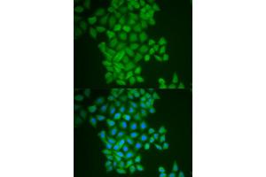 Immunofluorescence analysis of MCF-7 cell using FTH1 antibody. (FTH1 抗体)