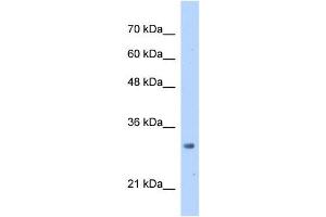 MRTO4 antibody used at 2. (C1orf33 抗体)