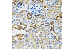 Immunohistochemistry of paraffin-embedded rat kidney using CASP3 antibody. (Caspase 3 抗体)