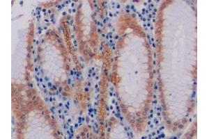 Detection of CD19 in Human Stomach Tissue using Polyclonal Antibody to Cluster Of Differentiation 19 (CD19)