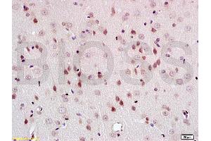 Formalin-fixed and paraffin embedded rat brain tissue labeled with Anti-PEG3 Polyclonal Antibody, Unconjugated (ABIN735653) at 1:200 followed by conjugation to the secondary antibody and DAB staining (PEG3 抗体  (AA 1501-1588))