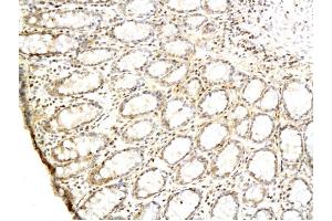 Formalin-fixed and paraffin embedded rat colon labeled with Anti-TGF alpha Polyclonal Antibody Unconjugated (ABIN724415) followed by conjugation to the secondary antibody and DAB staining (TGFA 抗体  (AA 40-89))