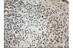 Immunohistochemistry (IHC) image for anti-Glutamate Decarboxylase 1 (Brain, 67kDa) (GAD1) antibody (ABIN2721536)